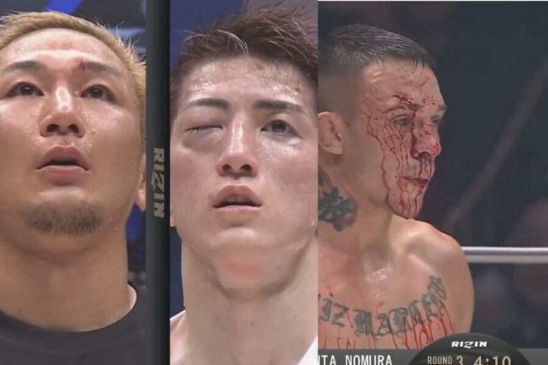 Jubiliejiniame „Rizin“ turnyre – nokautas per 26 sekundes, viena akimi likęs čempionas ir gydytojo draudimas Gustavo tęsti kovą